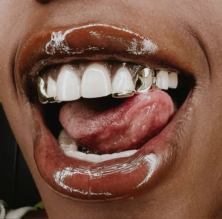 Gold tooth gems